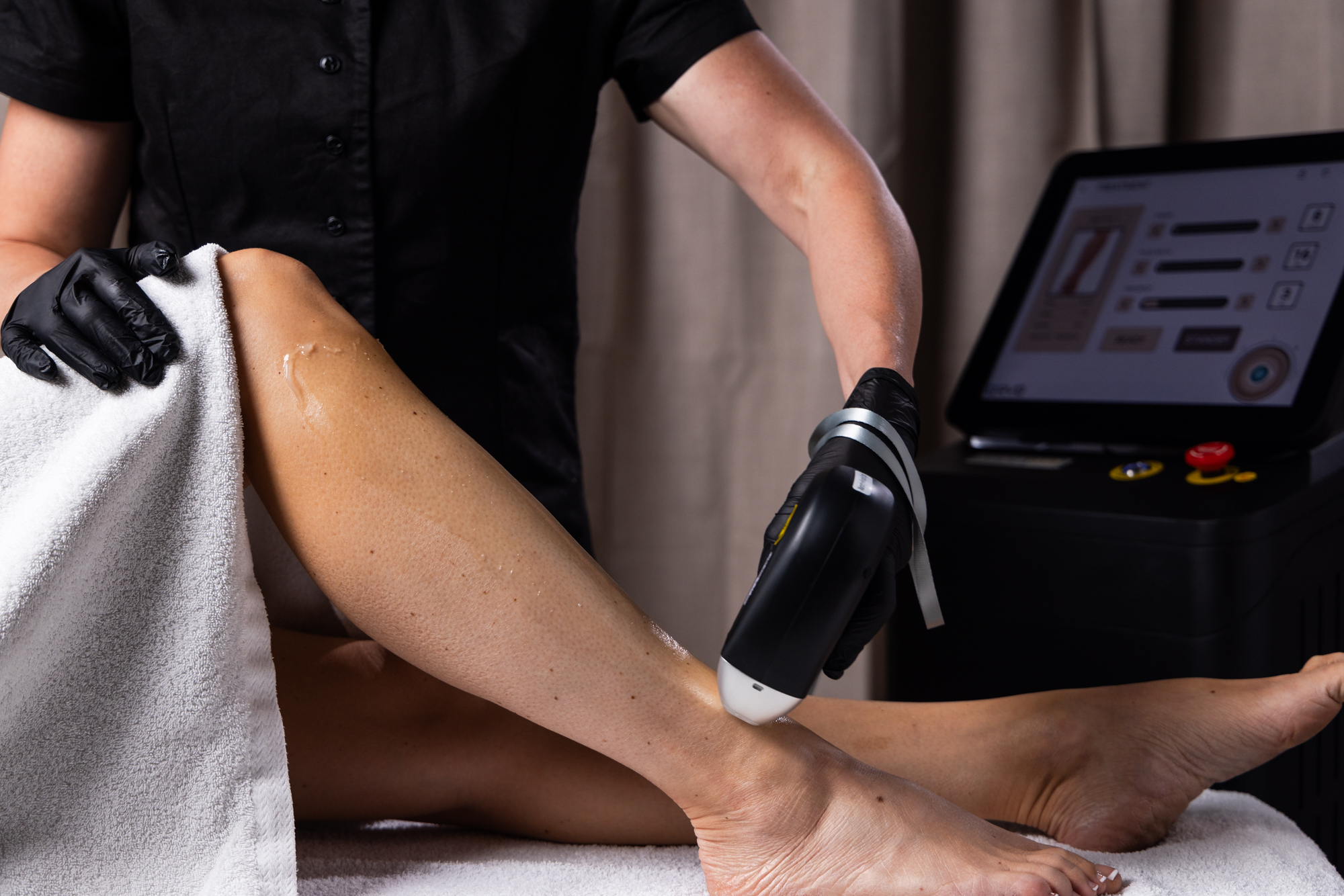 Laser hårborttagning behandling på Adel Care Clinic